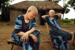 Two albino girls in Tanzania, 16-year-old Semeni and 12-year-old Sida, survivors of a criminal attack in the village of Segrama, Lake Victoria. In February 2009, five assassins invaded their hut and cut off the limbs of their 14-year-old sister, Unis Luguisha, who died afterwards. Limbs of albinos are sold illegally for 10.000 $ as talismen for good luck and wealth///Στην Τανζανία οι αλπίνοι έχουν μπει σε ένα εγκληματικό χρηματιστήριο. Μάγοι πουλούν σε προληπτικούς πελάτες, άκρα αλμπίνων προς 10,000 δολάρια, πείθοντας τους ότι φέρνουν τύχη και πλούτο. Στο χωριουδάκι Σεγκερέμα της λίμνης Βικτώρια, η Σεμένι και η Σίντα δεν είδαν την αδερφή τους να σφάζεται, ένα βράδυ που 5 κοκουλοφόροι μπήκαν στην καλύβα τους. Κρύφτηκαν κάτω από τα σκεπάσματα

 © Maro Kouri